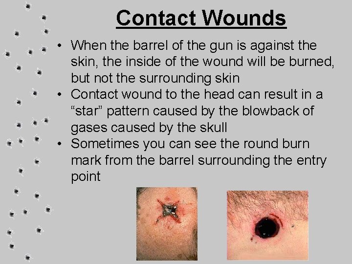 Contact Wounds • When the barrel of the gun is against the skin, the