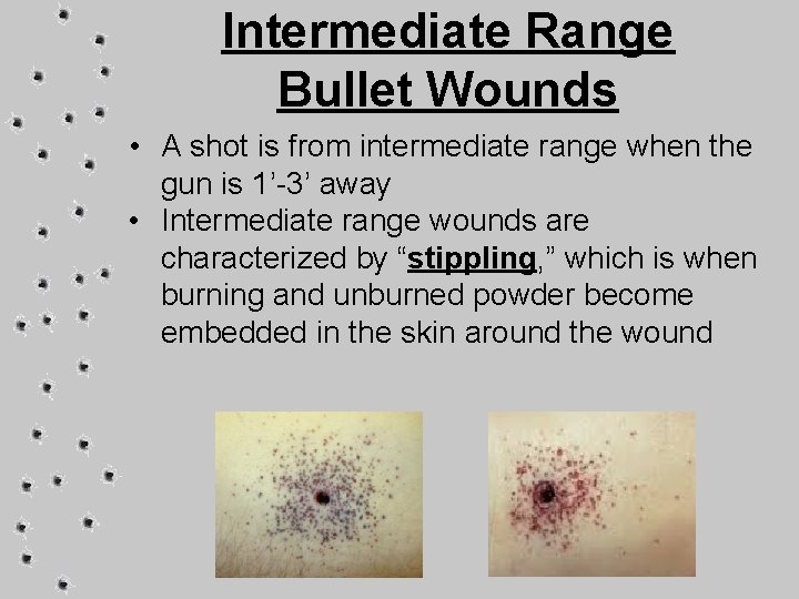 Intermediate Range Bullet Wounds • A shot is from intermediate range when the gun