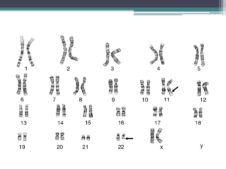 Chromosomal abnormalities 