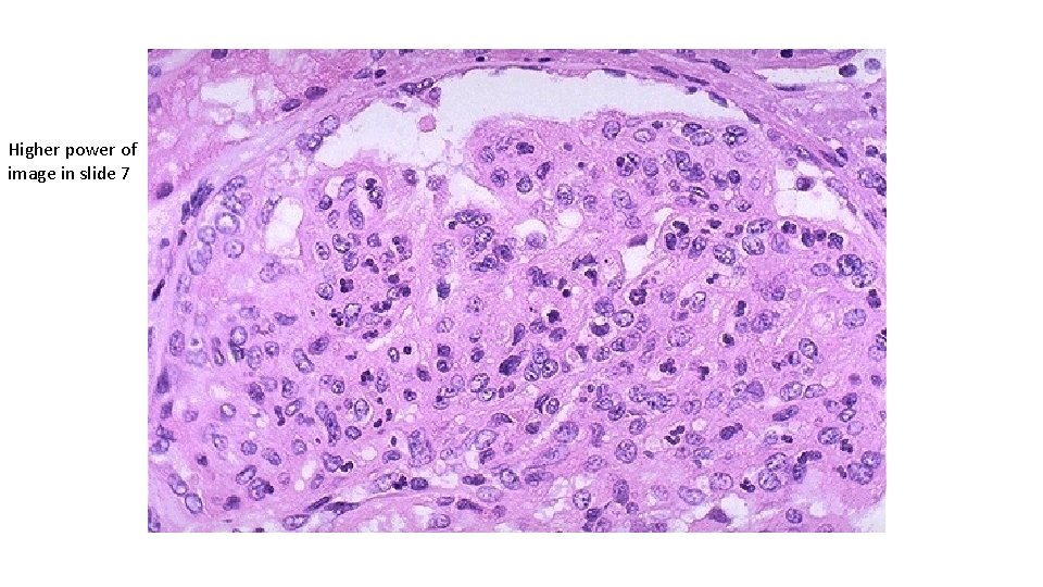 Higher power of image in slide 7 