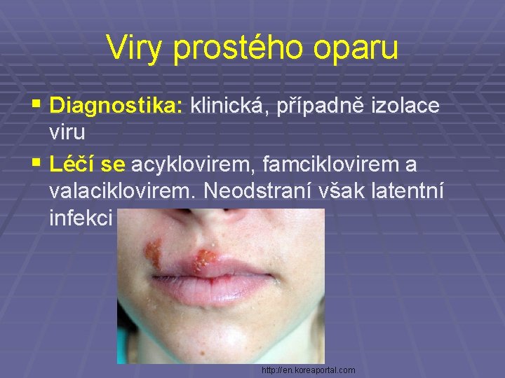 Viry prostého oparu § Diagnostika: klinická, případně izolace viru § Léčí se acyklovirem, famciklovirem