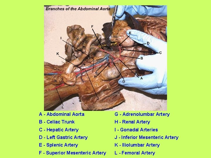 A - Abdominal Aorta G - Adrenolumbar Artery B - Celiac Trunk H -
