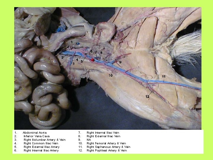 1. 2. 3. 4. 5. 6. Abdominal Aorta Inferior Vena Cava Right Iliolumbar Artery