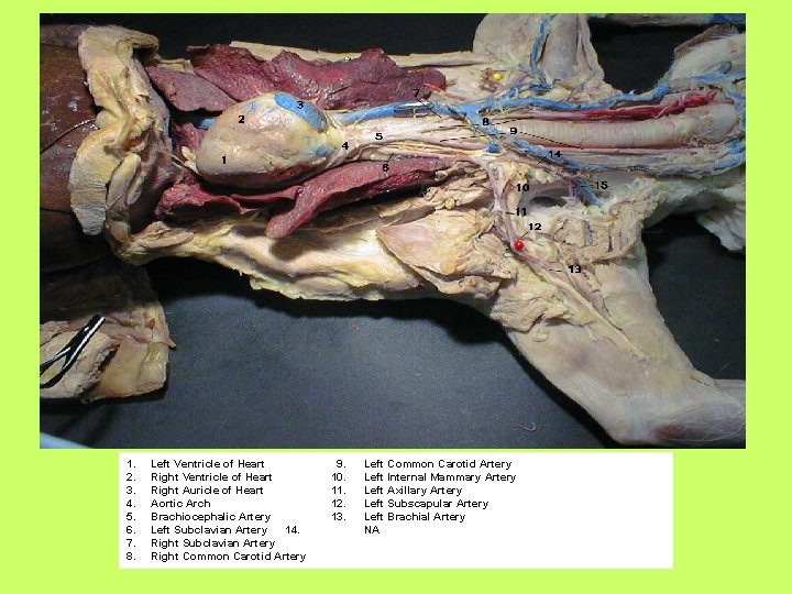 1. 2. 3. 4. 5. 6. 7. 8. Left Ventricle of Heart Right Auricle