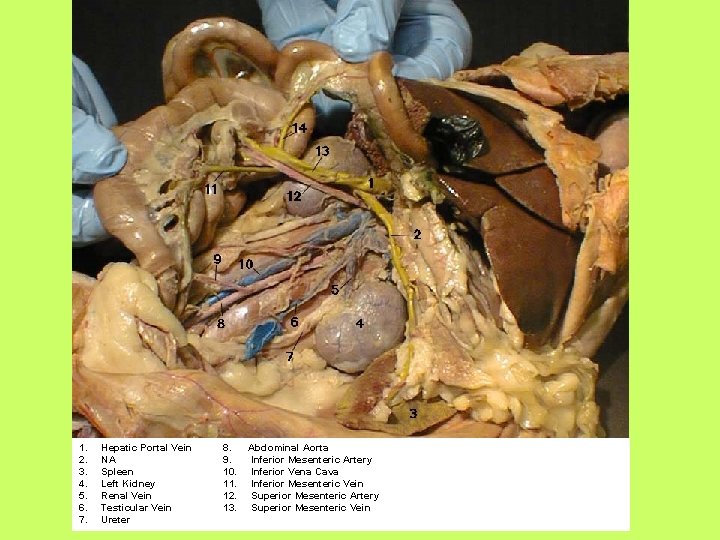 1. 2. 3. 4. 5. 6. 7. Hepatic Portal Vein NA Spleen Left Kidney