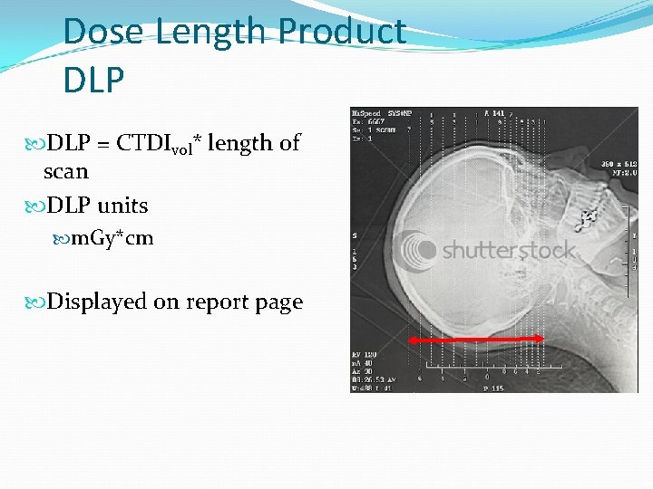 Dose Length Product DLP = CTDIvol* length of scan DLP units m. Gy*cm Displayed