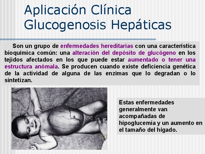 Aplicación Clínica Glucogenosis Hepáticas Son un grupo de enfermedades hereditarias con una característica bioquímica