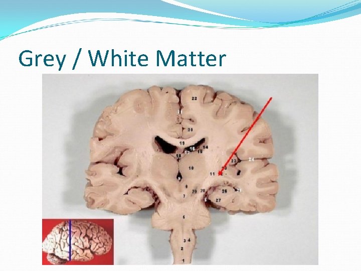 Grey / White Matter 