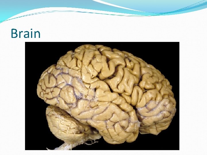 Brain 