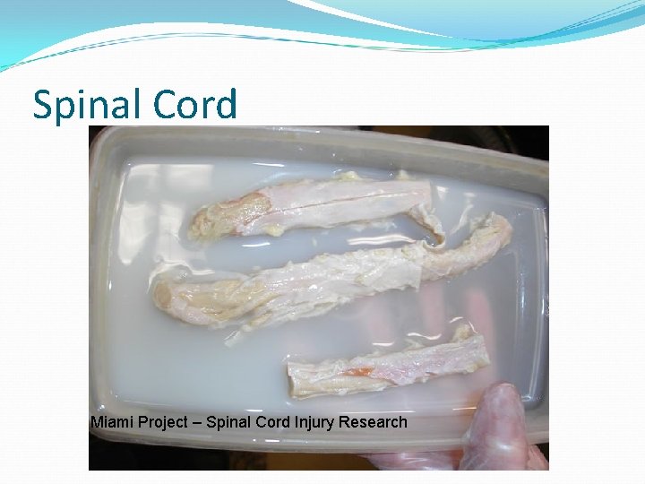 Spinal Cord Miami Project – Spinal Cord Injury Research 