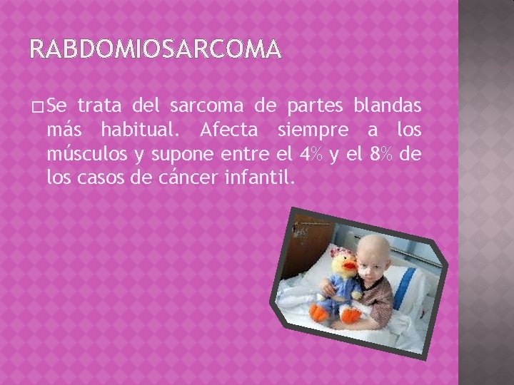 RABDOMIOSARCOMA � Se trata del sarcoma de partes blandas más habitual. Afecta siempre a