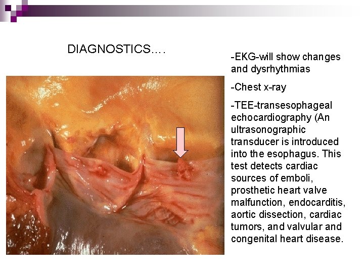 DIAGNOSTICS…. -EKG-will show changes and dysrhythmias -Chest x-ray -TEE-transesophageal echocardiography (An ultrasonographic transducer is