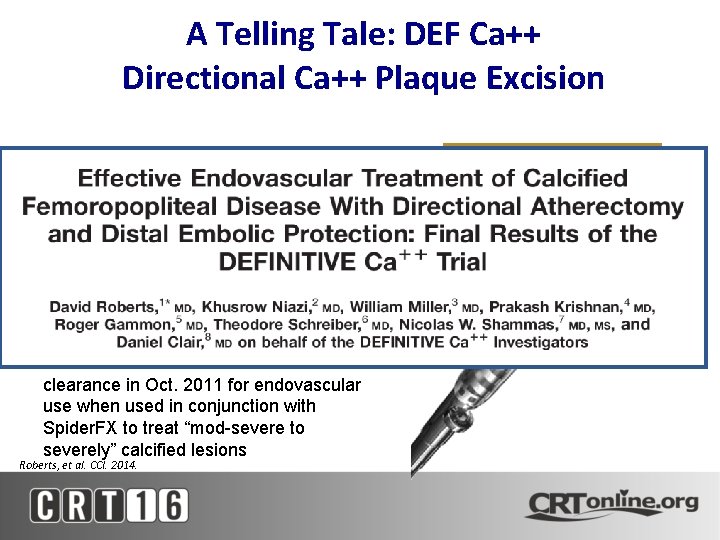 A Telling Tale: DEF Ca++ Directional Ca++ Plaque Excision Silver. Hawk LS-C model was