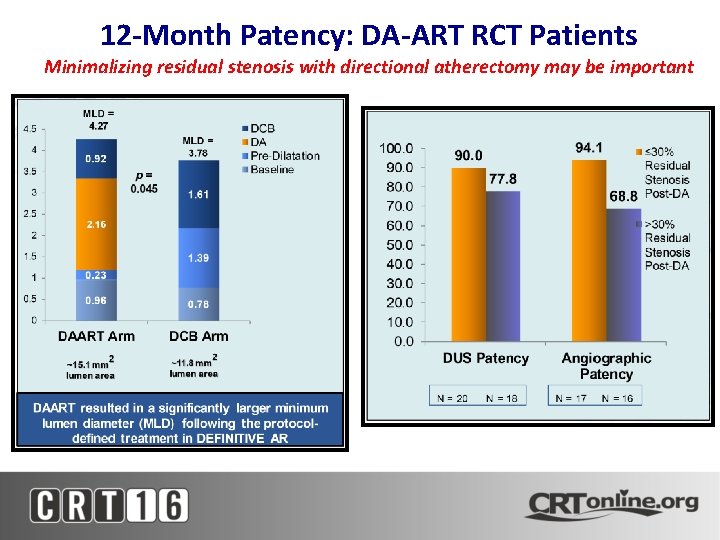 12 -Month Patency: DA-ART RCT Patients Minimalizing residual stenosis with directional atherectomy may be