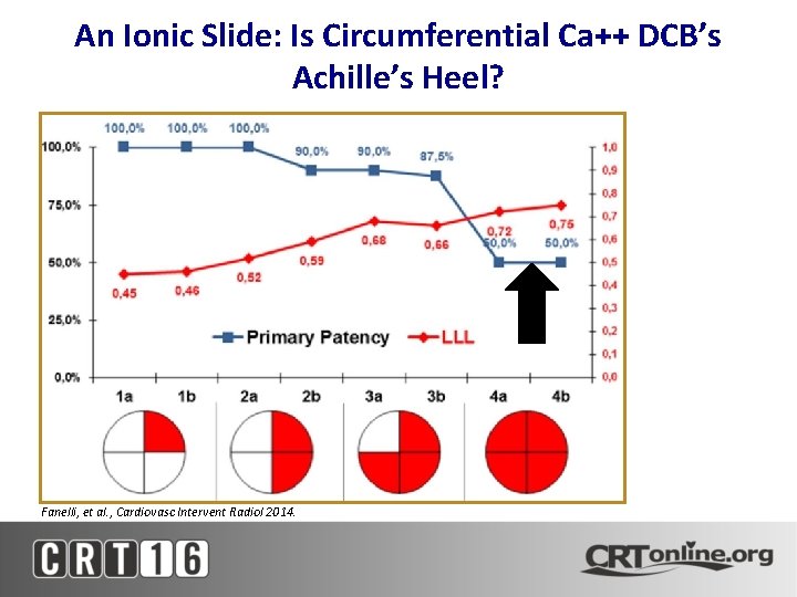An Ionic Slide: Is Circumferential Ca++ DCB’s Achille’s Heel? Fanelli, et al. , Cardiovasc