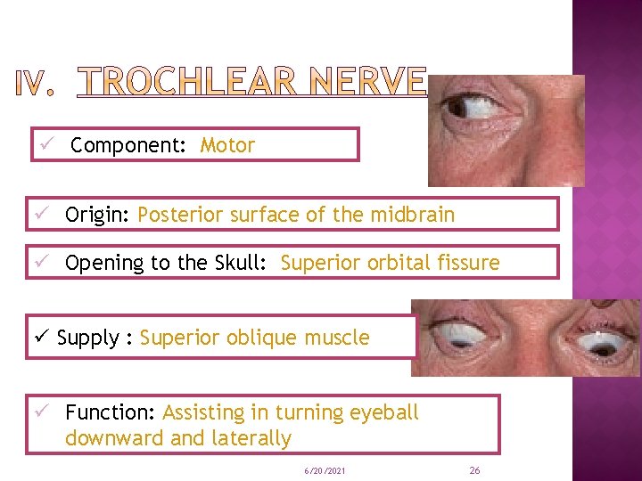 ü Component: Motor ü Origin: Posterior surface of the midbrain ü Opening to the