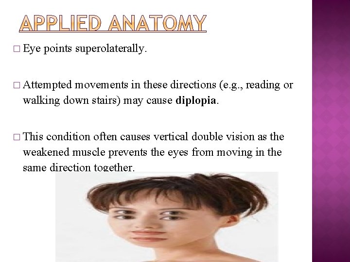� Eye points superolaterally. � Attempted movements in these directions (e. g. , reading