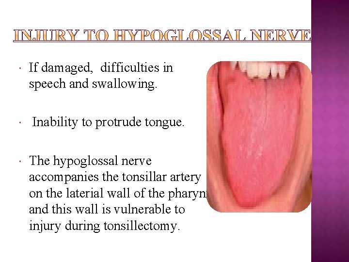  If damaged, difficulties in speech and swallowing. Inability to protrude tongue. The hypoglossal