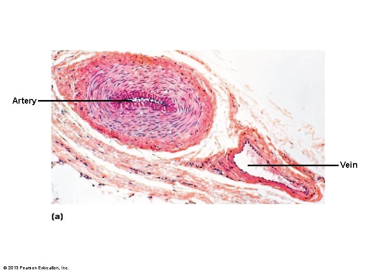 Artery Vein © 2013 Pearson Education, Inc. 