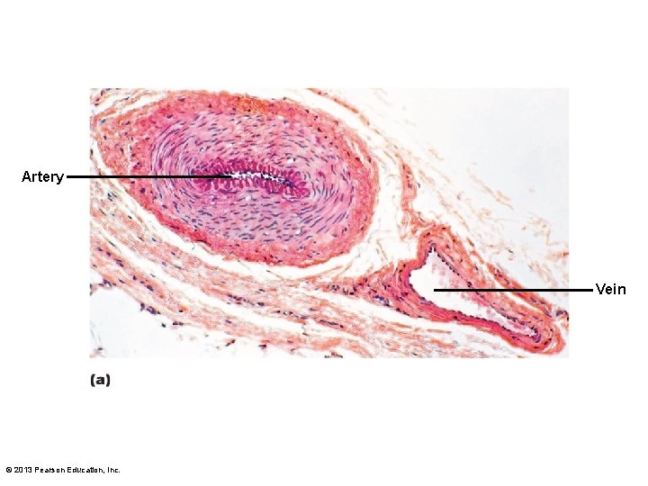 Artery Vein © 2013 Pearson Education, Inc. 
