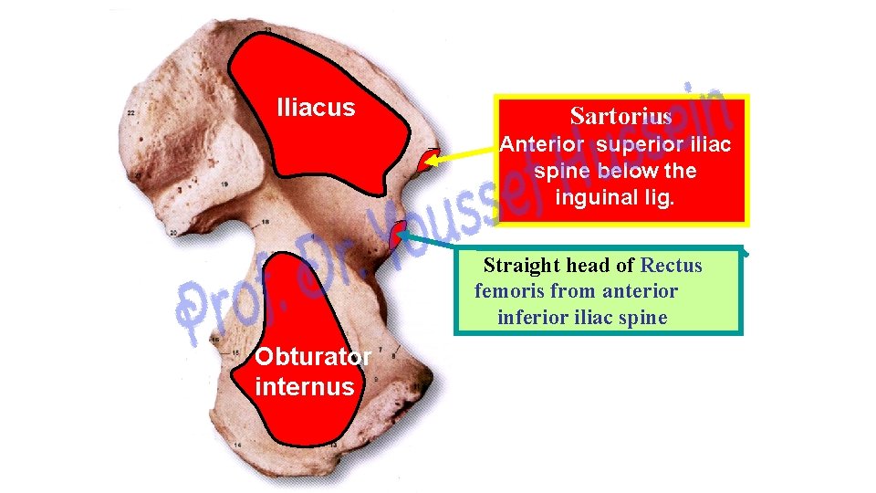 Iliacus Sartorius Anterior superior iliac spine below the inguinal lig. Straight head of Rectus