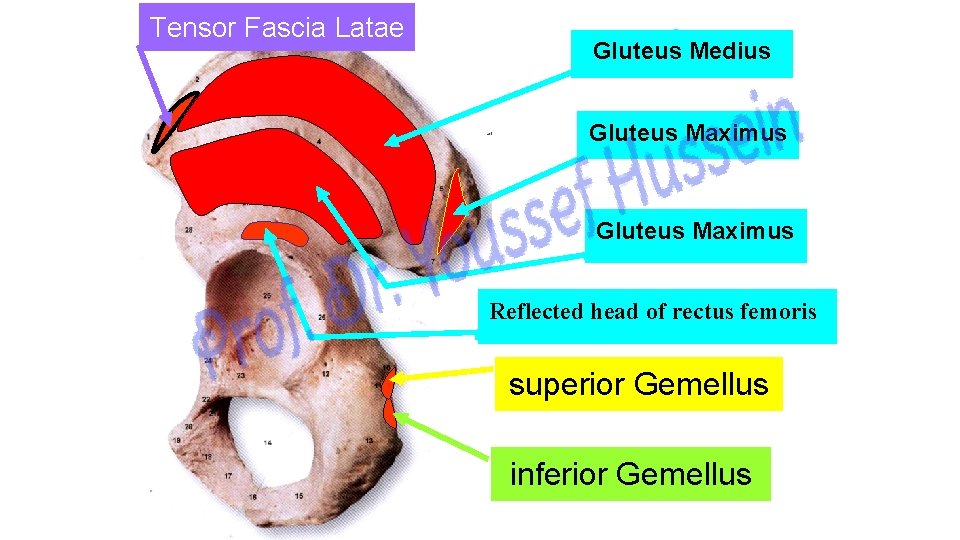 Tensor Fascia Latae Gluteus Medius Gluteus Maximus Reflected head of rectus femoris superior Gemellus