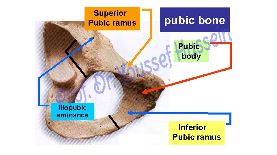 Superior Pubic ramus pubic bone Pubic body Iliopubic eminance Inferior Pubic ramus 