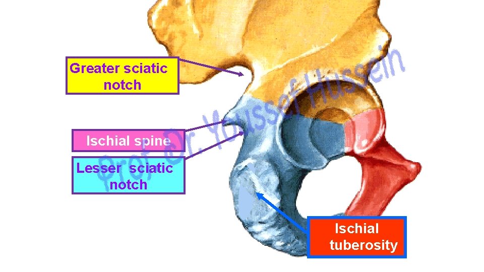 Greater sciatic notch Ischial spine Lesser sciatic notch Ischial tuberosity 