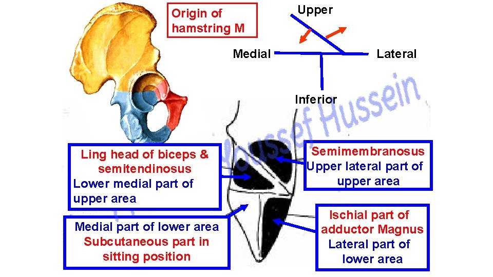 Origin of hamstring M Upper Lateral Medial Inferior Ling head of biceps & semitendinosus