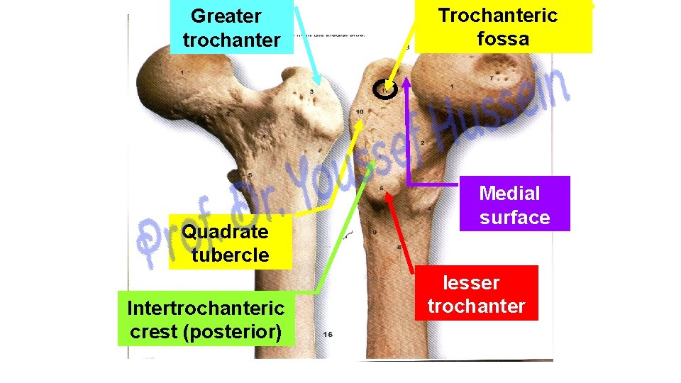 Greater trochanter Quadrate tubercle Intertrochanteric crest (posterior) Trochanteric fossa Medial surface lesser trochanter 