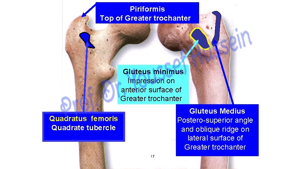 Piriformis Top of Greater trochanter Gluteus minimus Impression on anterior surface of Greater trochanter