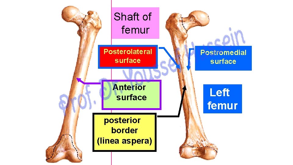 Shaft of femur Posterolateral surface Anterior surface posterior border (linea aspera) Postromedial surface Left