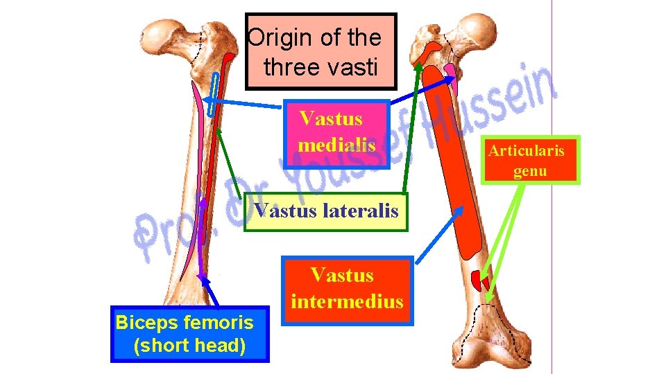 Origin of the three vasti Vastus medialis Vastus lateralis Biceps femoris (short head) Vastus