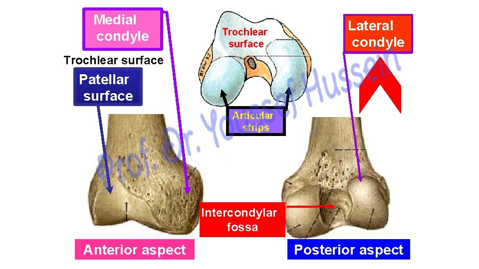 Medial condyle Trochlear surface Lateral condyle Trochlear surface Patellar surface Articular strips Intercondylar fossa
