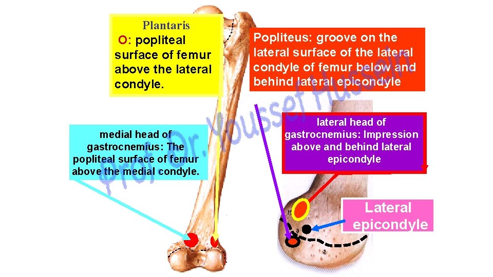 Plantaris O: popliteal surface of femur above the lateral condyle. medial head of gastrocnemius: