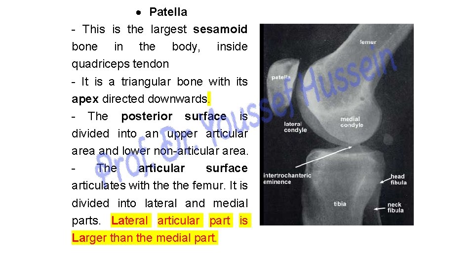  Patella - This is the largest sesamoid bone in the body, inside quadriceps