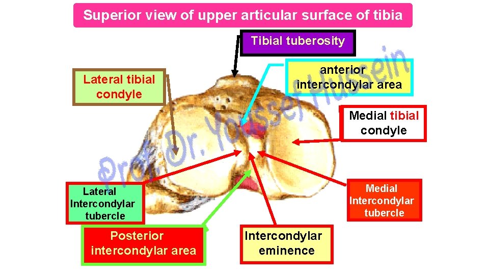 Superior view of upper articular surface of tibia Tibial tuberosity Lateral tibial condyle anterior