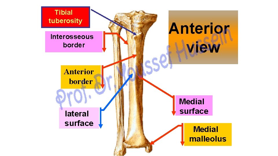 Tibial tuberosity Interosseous border Anterior view Anterior border lateral surface Medial malleolus 