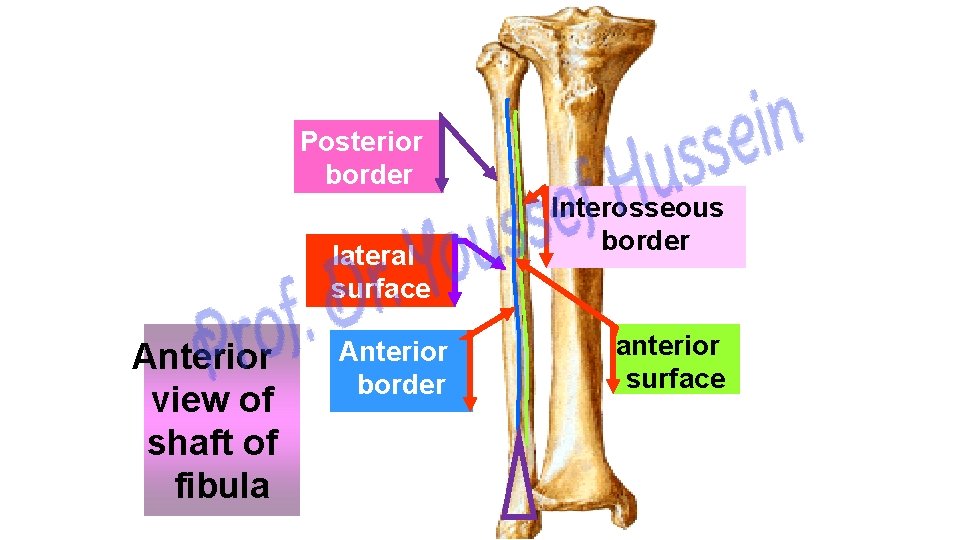 Posterior border lateral surface Anterior view of shaft of fibula Anterior border Interosseous border