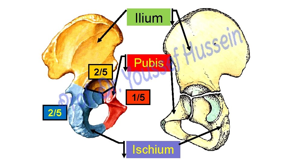 Ilium 2/5 Pubis 1/5 2/5 Ischium 