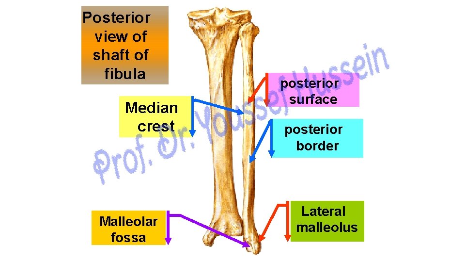 Posterior view of shaft of fibula Median crest Malleolar fossa posterior surface posterior border