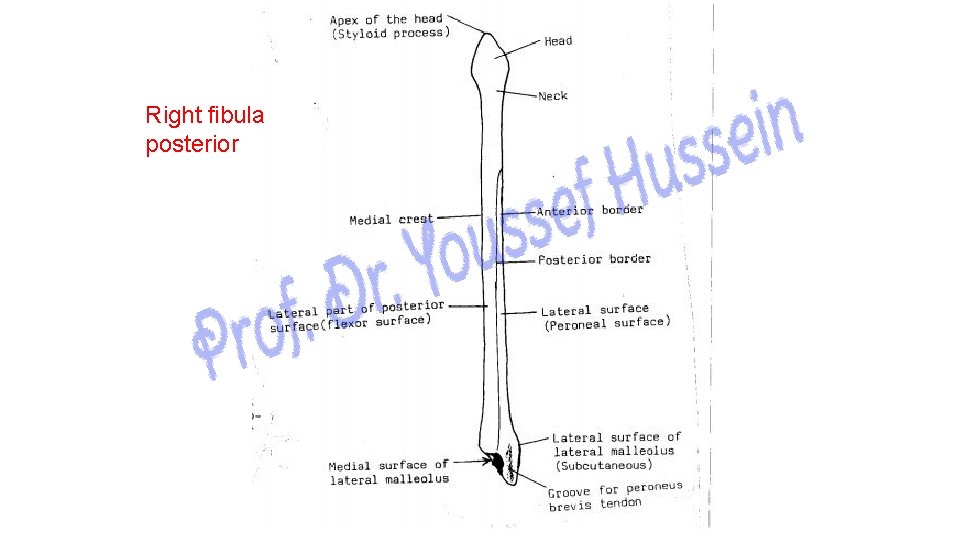 Right fibula posterior 
