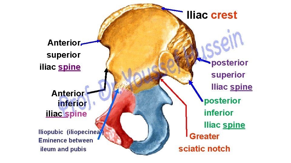 Iliac crest Anterior superior iliac spine Anterior inferior iliac spine Iliopubic (iliopecineal) Eminence between