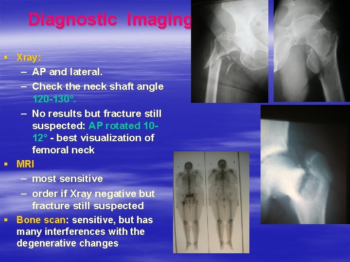 Diagnostic Imaging § Xray: – AP and lateral. – Check the neck shaft angle