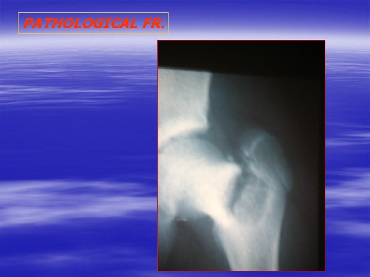 PATHOLOGICAL FR. 
