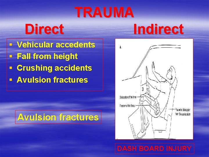 TRAUMA Direct Indirect § § Vehicular accedents Fall from height Crushing accidents Avulsion fractures