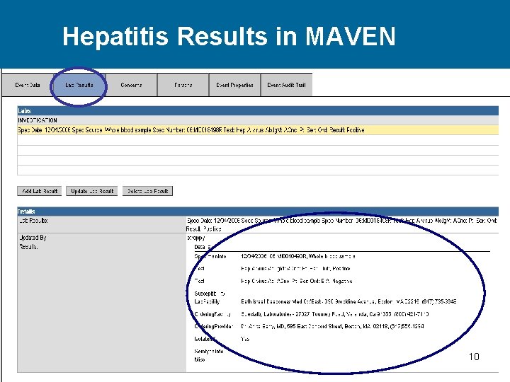 Hepatitis Results in MAVEN 10 
