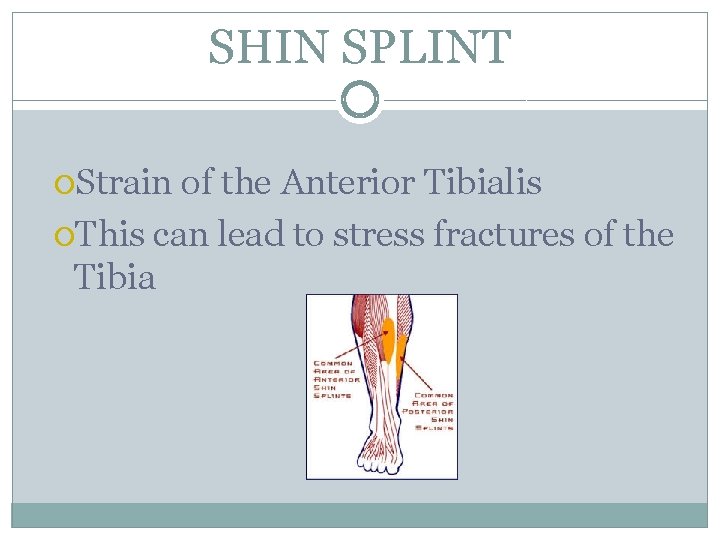 SHIN SPLINT Strain of the Anterior Tibialis This can lead to stress fractures of