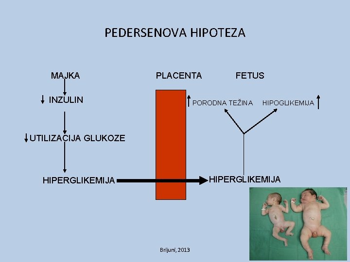 PEDERSENOVA HIPOTEZA MAJKA PLACENTA INZULIN FETUS PORODNA TEŽINA HIPOGLIKEMIJA UTILIZACIJA GLUKOZE HIPERGLIKEMIJA Brijuni, 2013