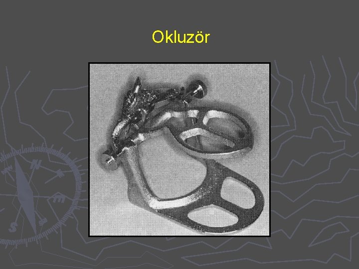 Okluzör 